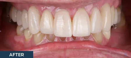 Smile with healthier teeth and gums